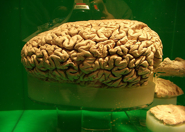 The brain of a whale preserved in a large glass jar.